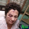 Policías del retén en El Jobo golpean a mujer, no han sido consignados Patricia González fue golpeada por policías estatales cuando se negó a bajar de su auto en un retén. Foto: Cortesía
