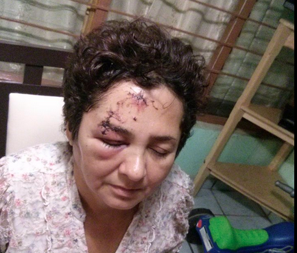 Patricia González fue golpeada por policías estatales cuando se negó a bajar de su auto en un retén. Foto: Cortesía