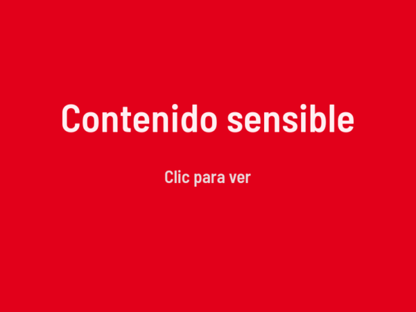 Contenido sensible, clic para ver.