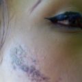 Migrante violentado por presuntos agentes del INM 000