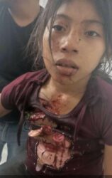 Una niña entre los heridos y sobrevivientes del ataque armado del viernes