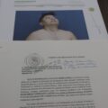 Dulce Esmeralda, la policía víctima de violencia ácida e institucional Dictamen médico.