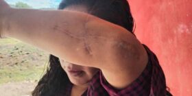“Hoy temo por mi vida, un juez liberó a quien quiso matarme” Guillermina, indígena mixteca y sobreviviente de feminicidio
Foto: Istmo Press